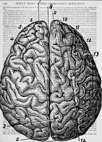 Vintage-anatomical-drawing-Brain-Dictionary-Art-Print.jpg