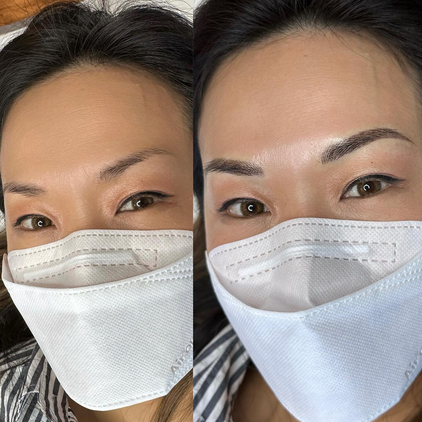 Most common brow problem among a lot of my clients is missing brow hairs at the tail of the brows. A little feathering and the brows are full and defined again 🫶🏼✨
&mdash;
Skin type: Dry
Technique: Nano Feather Brows
Pain level: None
Appointment ti