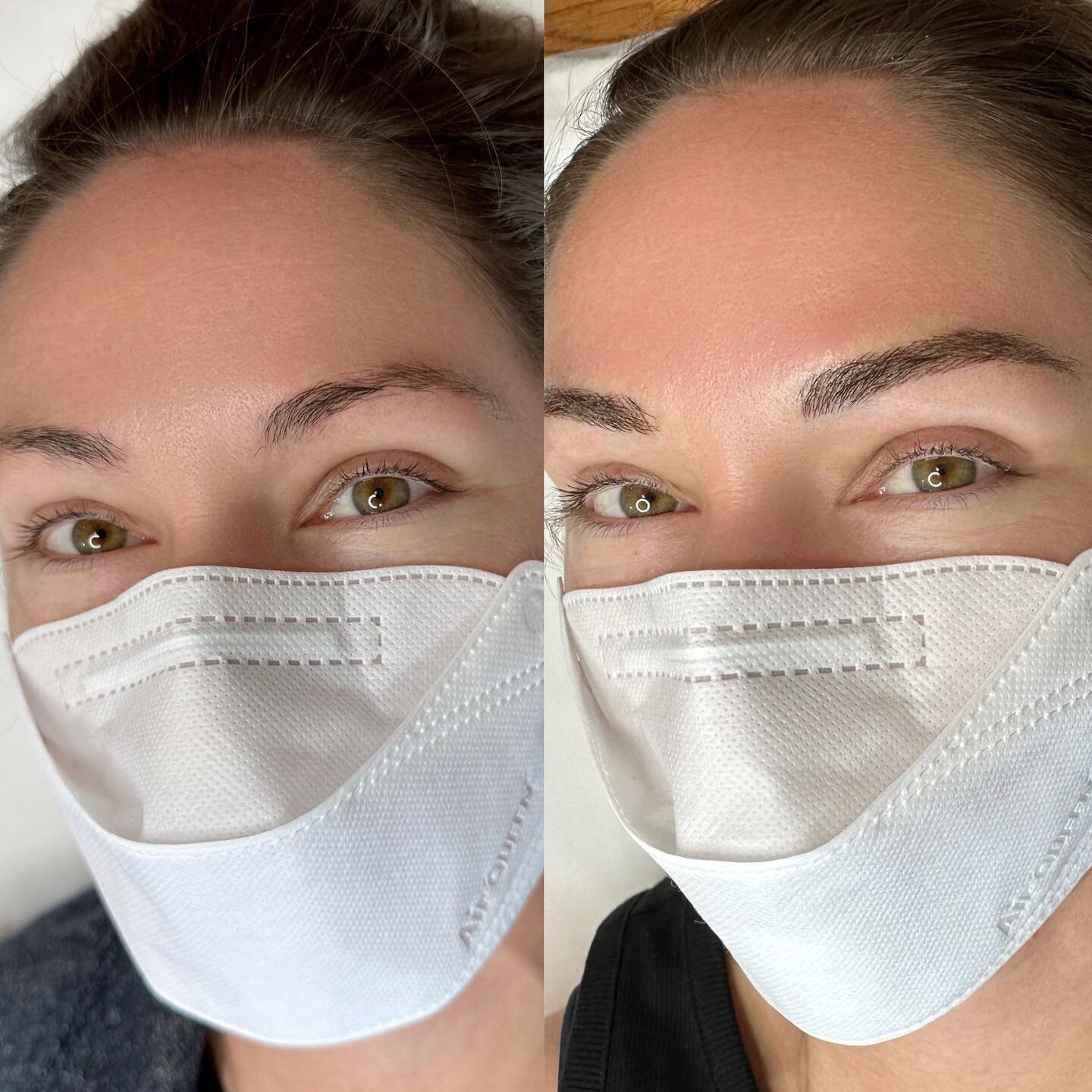 June calendar is open!
&mdash;
Skin type: Combination
Technique: Nano Feather Brows
Pain level: None
Appointment time: 2 hours
Sessions: 2 required
Healing time: 7-10 days (no scabbing)
Last: 2-3 years (depends on skin type)
&mdash;
For pricing &amp;