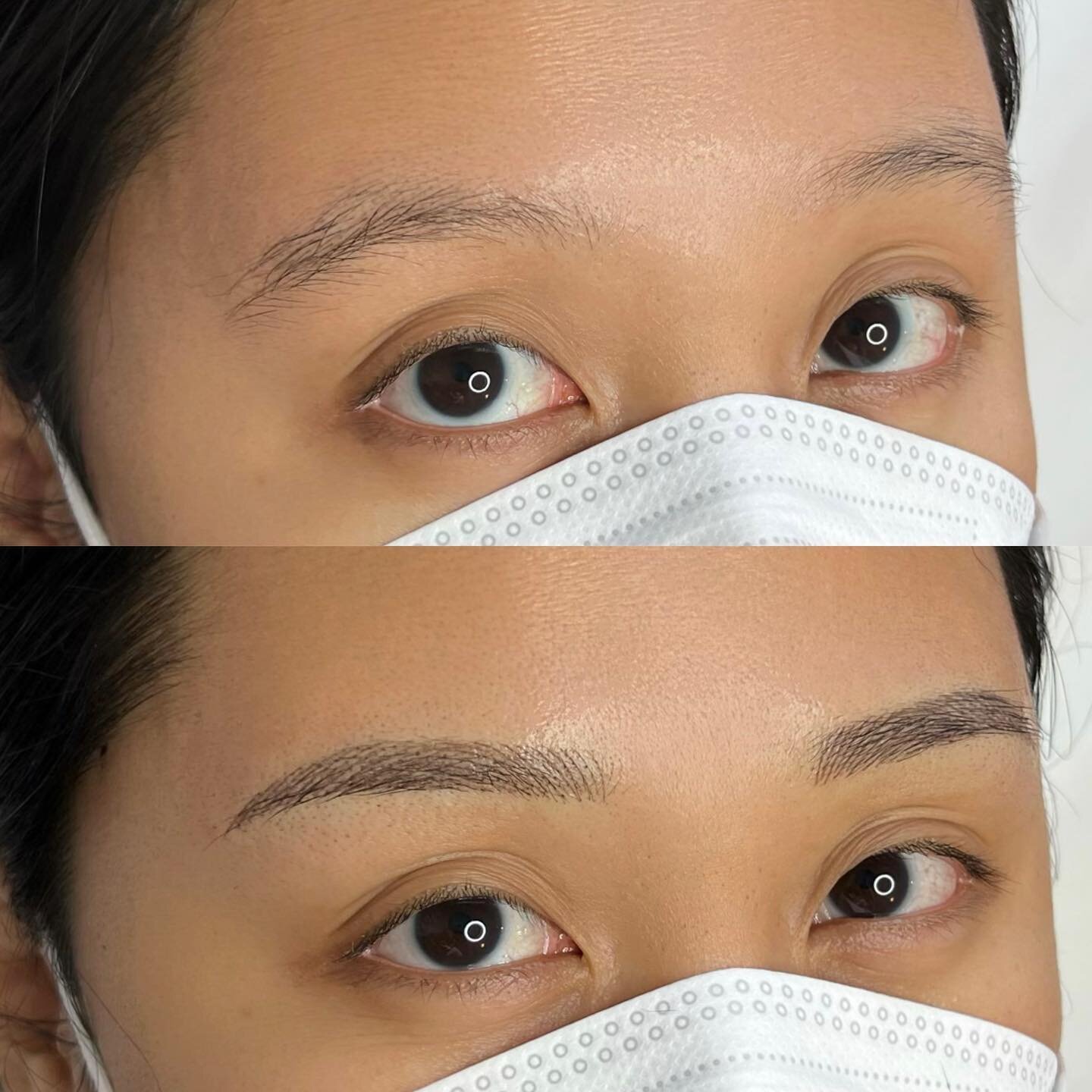 Love this transformation! The thinnest &amp; softest nano strokes #nanofeatherbrows 
&mdash;
Skin type: Combination
Technique: Nano Feather Brows
Pain level: None
Appointment time: 2 hours
Sessions: 2 required
Healing time: 7-10 days (no scabbing)
La