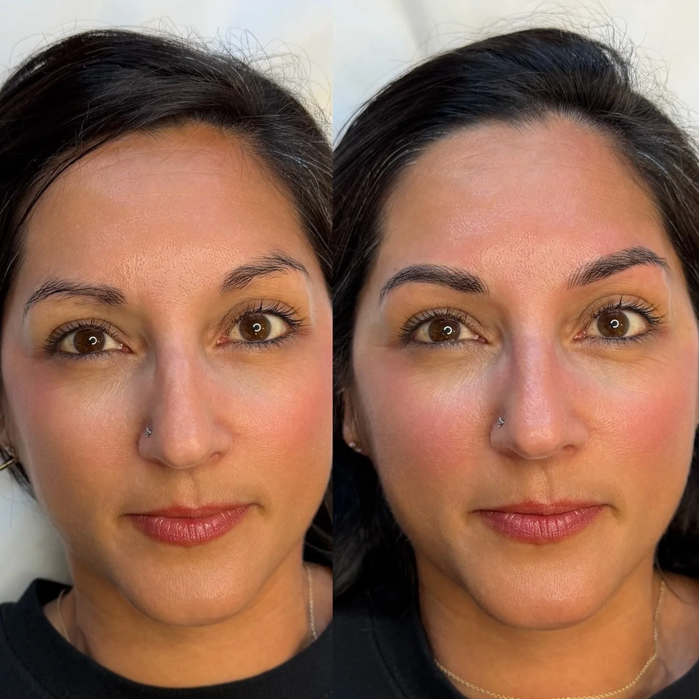 She wanted fuller but subtle 📝 I gotchuuu 🤩
&mdash;
Skin type: Normal/dry
Technique: Nano Feather Brows
Pain level: None
Appointment time: 2 hours
Sessions: 2 required
Healing time: 7-10 days (no scabbing)
Last: 2-3 years (depends on skin type)
&md