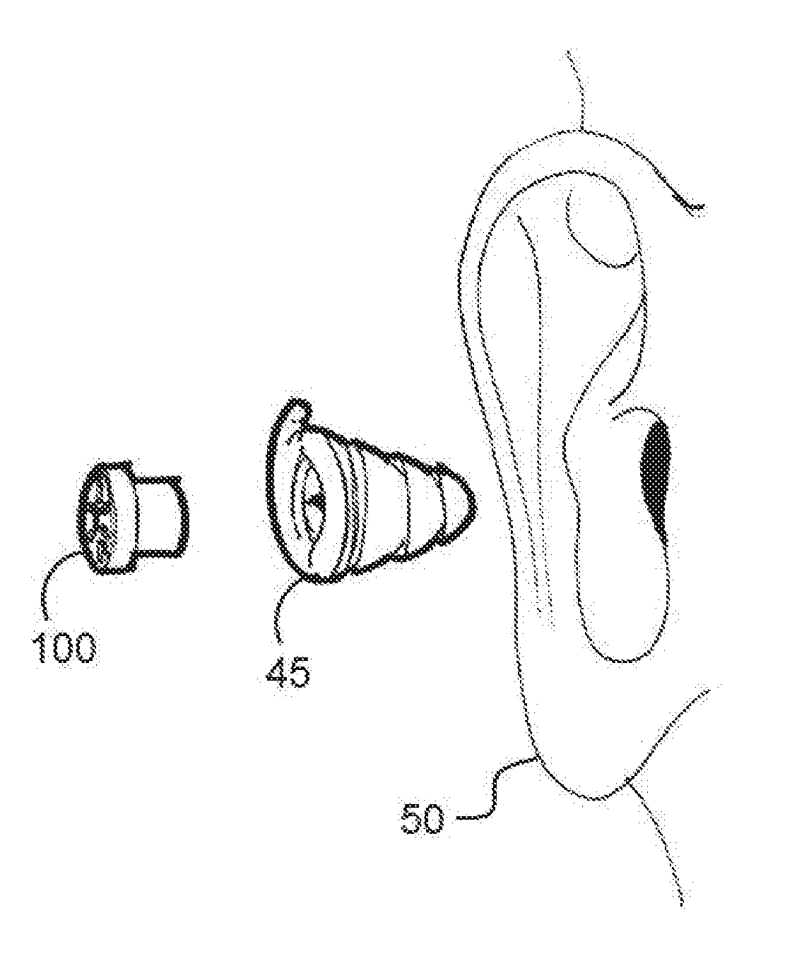 US20180098885A1-20180412-D00000.png