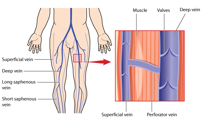 psihosomatica varicoza picior