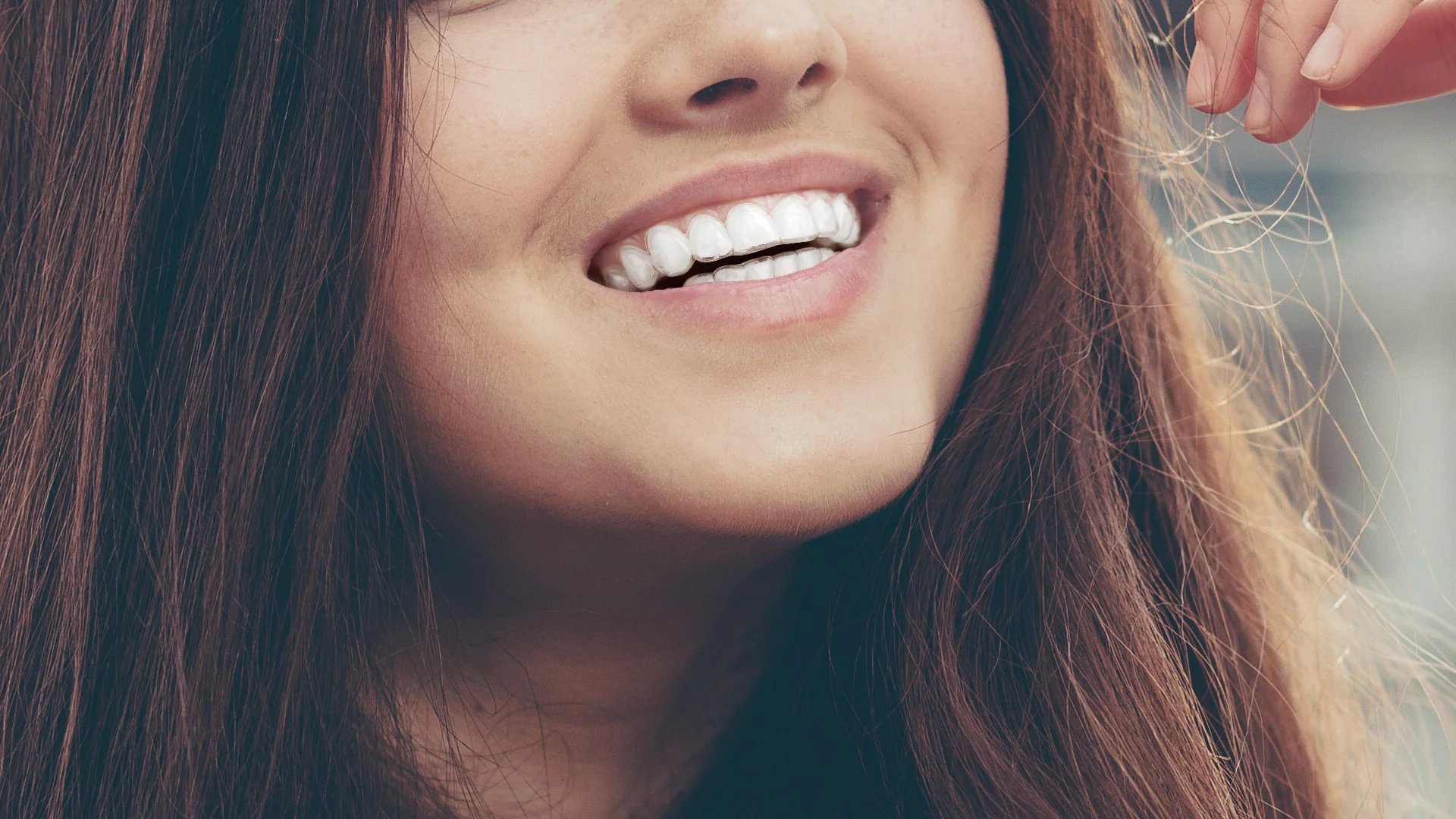 Invisalign.jpg