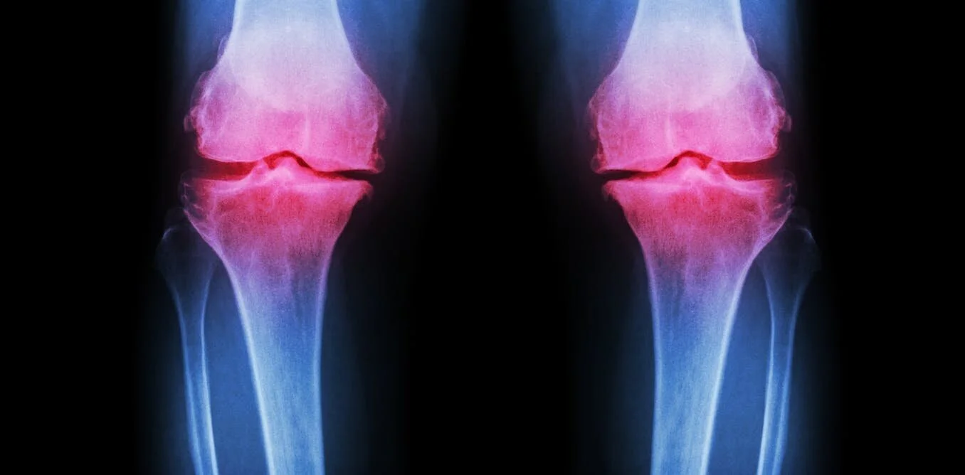 Exercises for Osteoarthritis.jpg