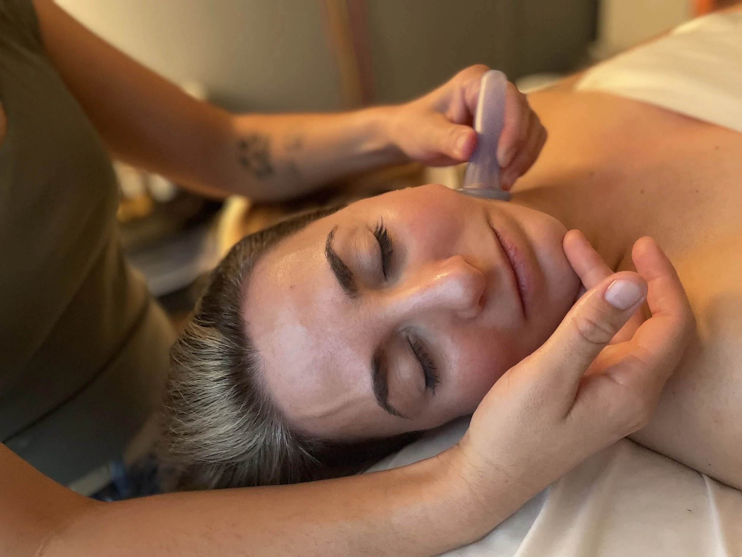 Facial cupping being done as part of the facial rejuvenation treatment at Revive