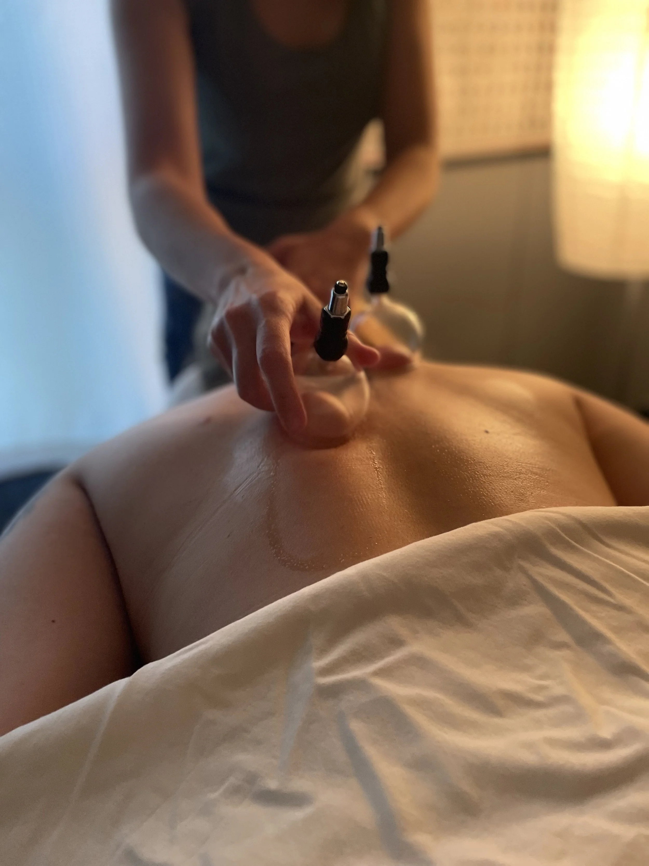Cupping Therapy being done on a client's back
