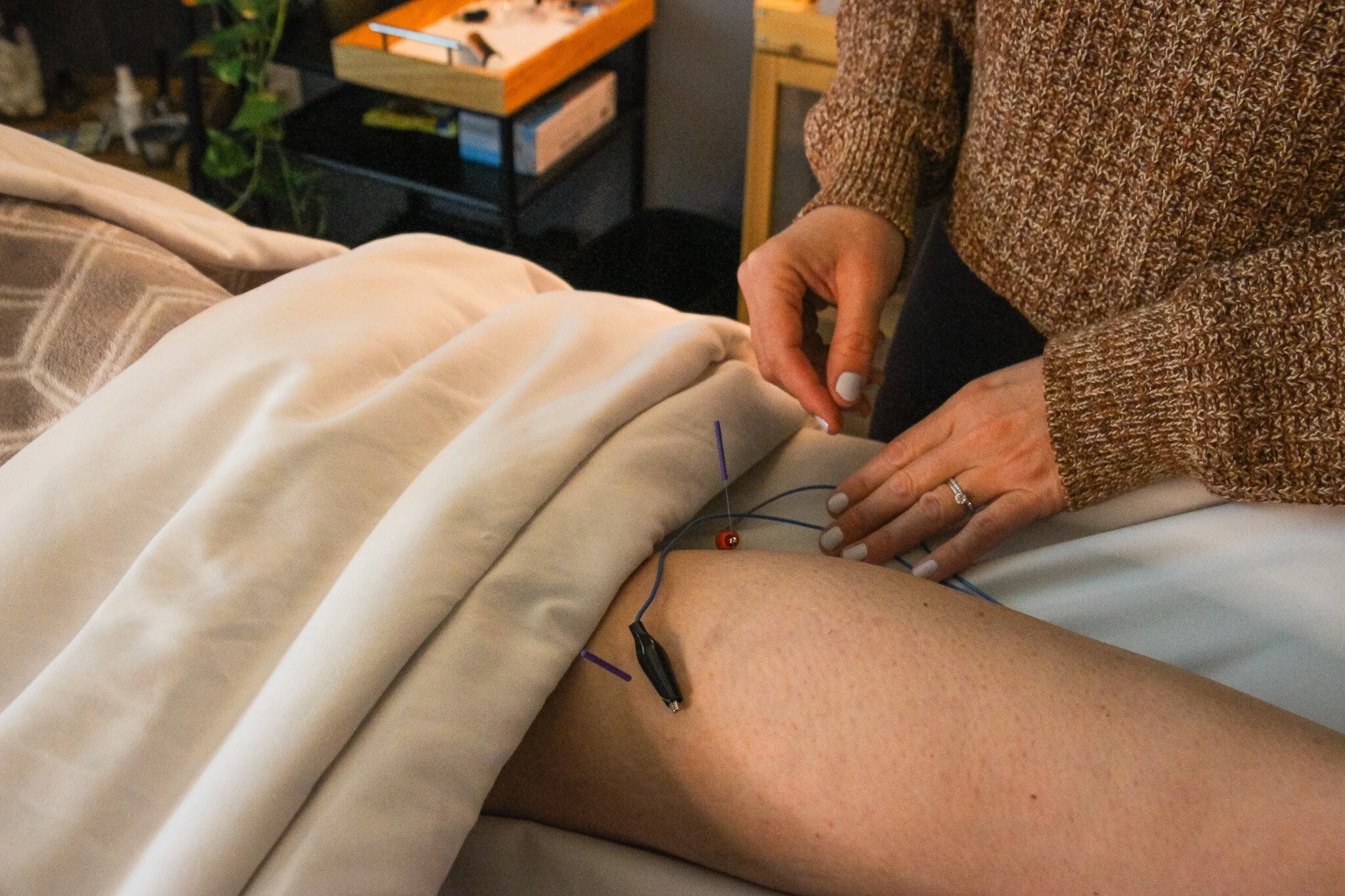 A picture of e-stim or electroacupuncture done on the calf muscles at Revive Acupuncture and Wellness in Berwick, ME