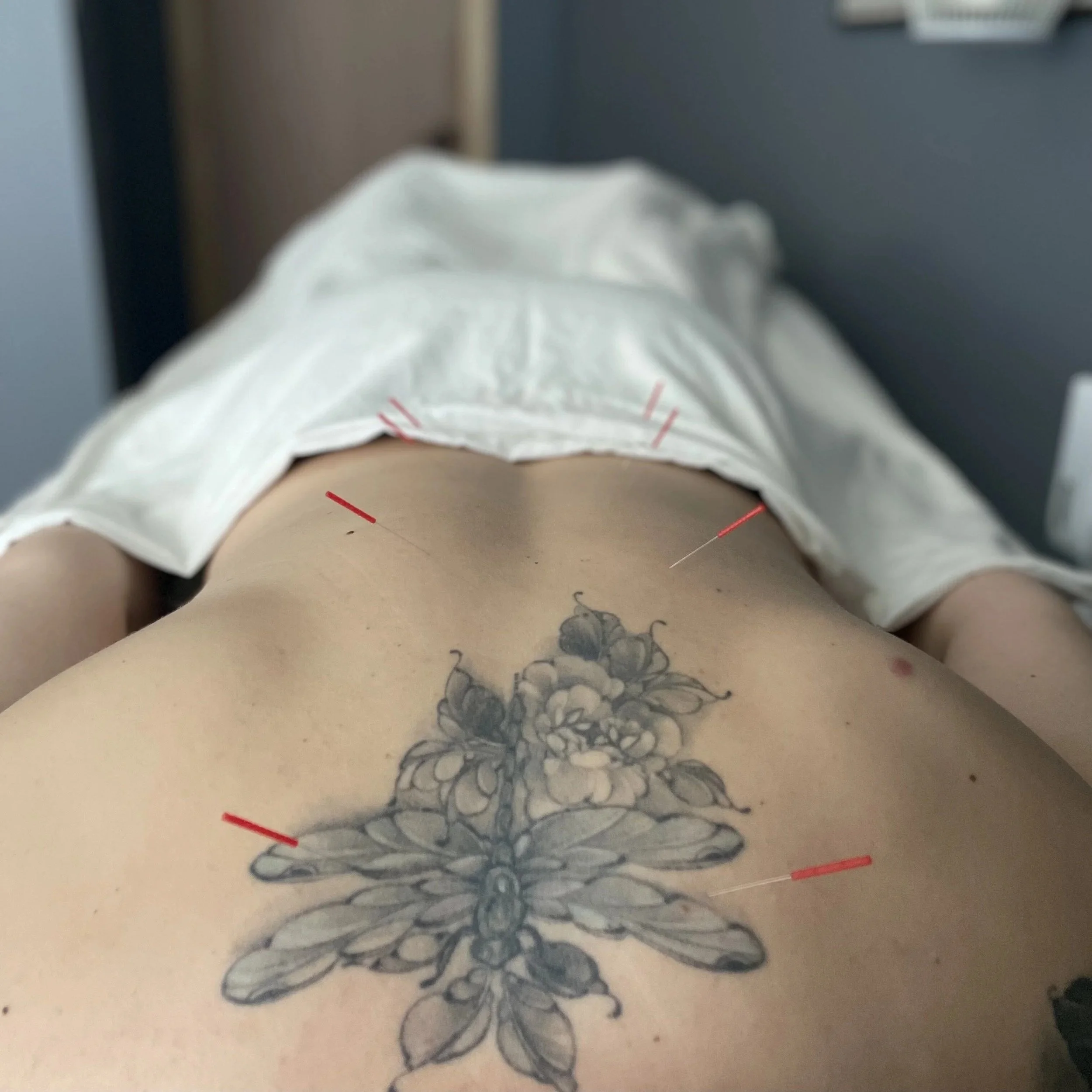 Acupuncture points on a client's back