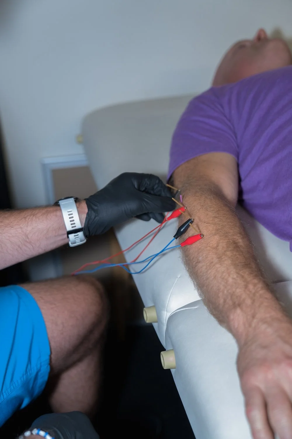 Physical therapist applying electrical stimulation dry needling to a client with tennis elbow.