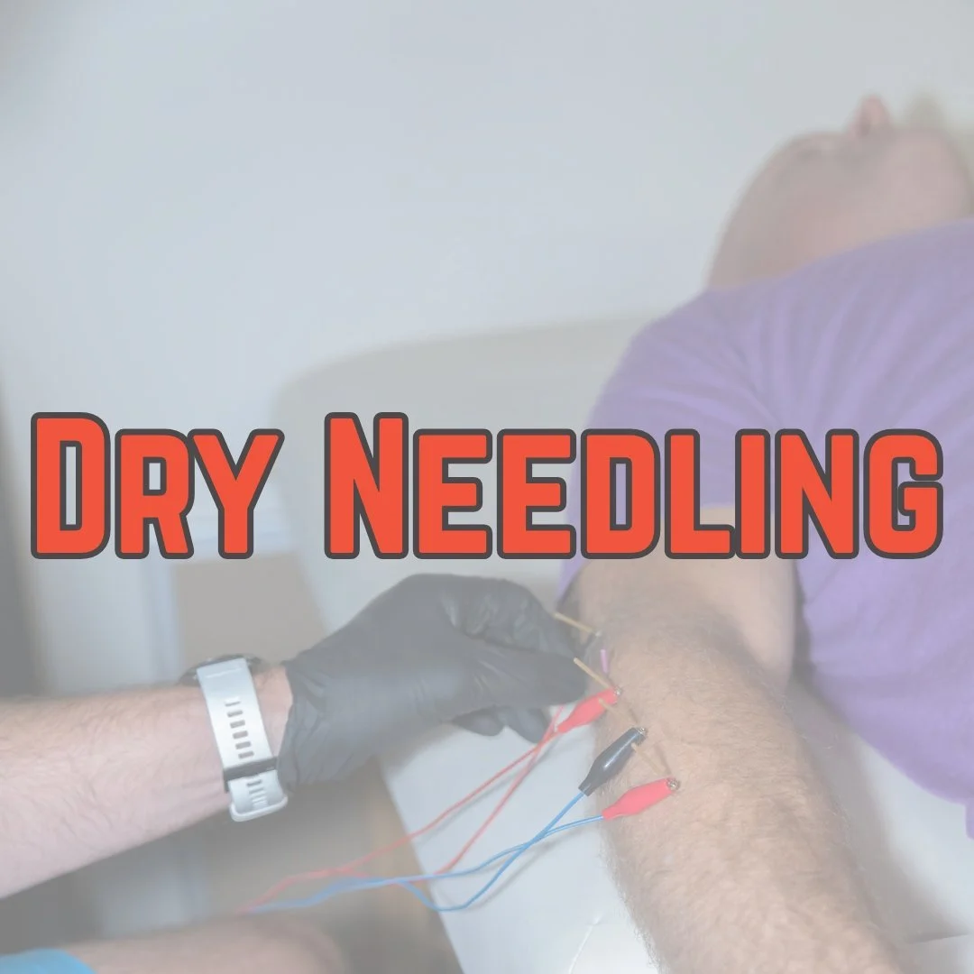 A performance physical therapist applying dry needling to an athlete's arm for tennis elbow