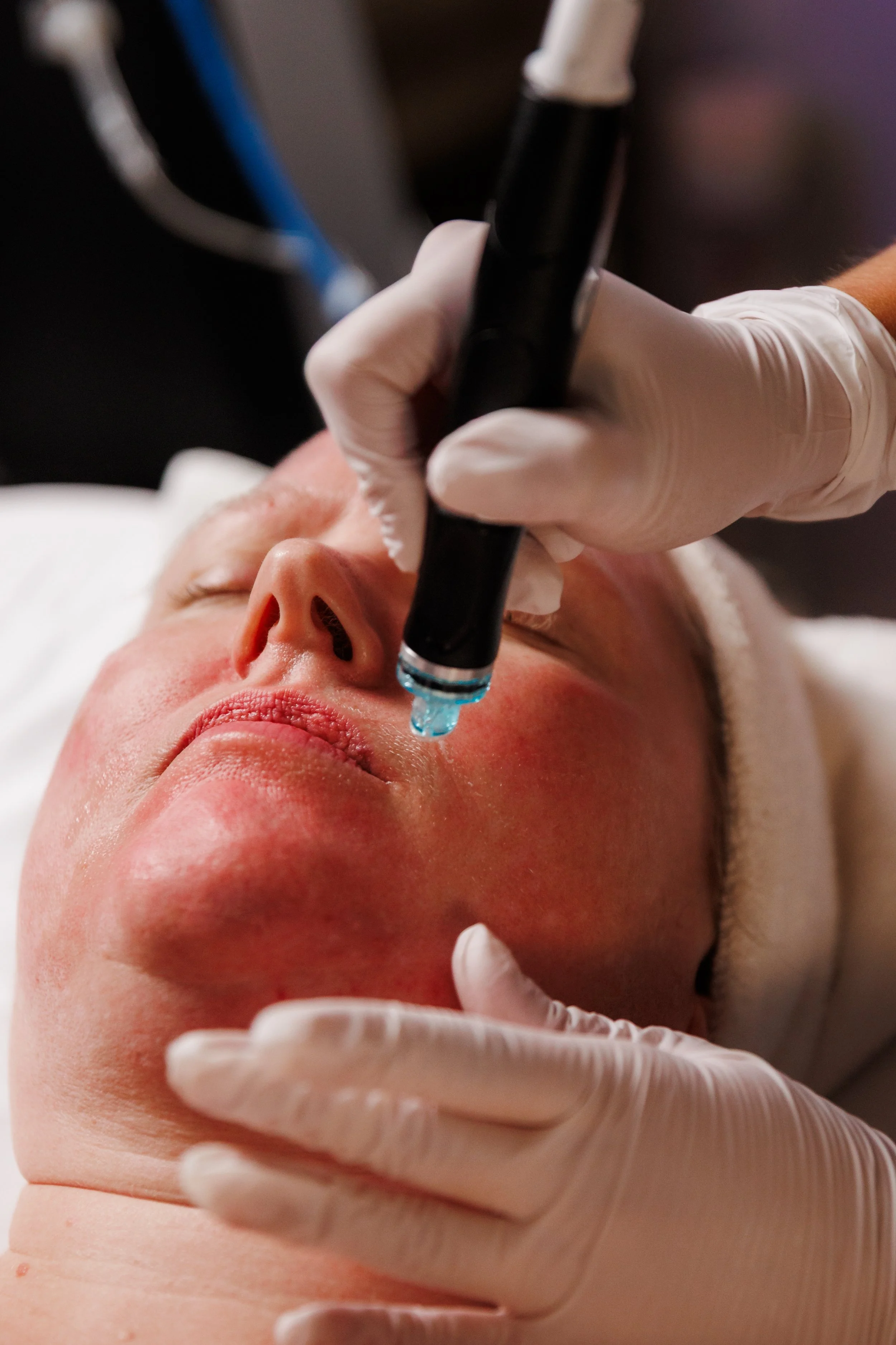 A person receiving a facial treatment, with a focus on a skincare device being used on their chin, while another person in white gloves holds the device.
