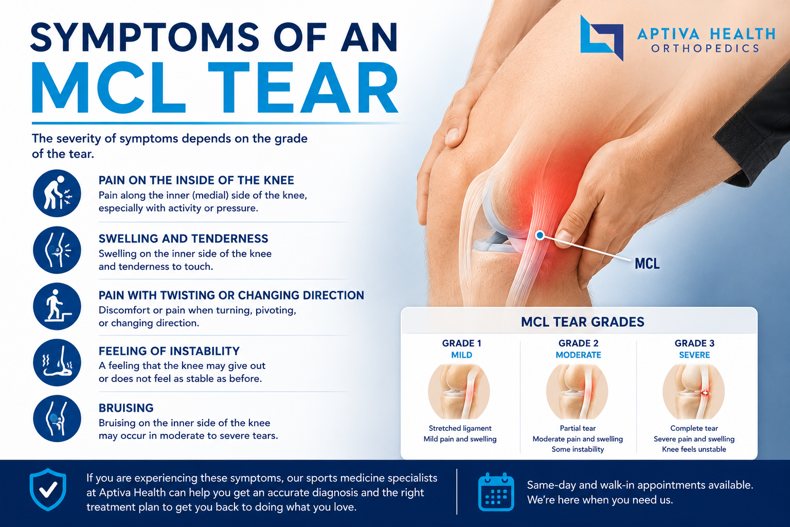 Symptoms of an MCL Tear
