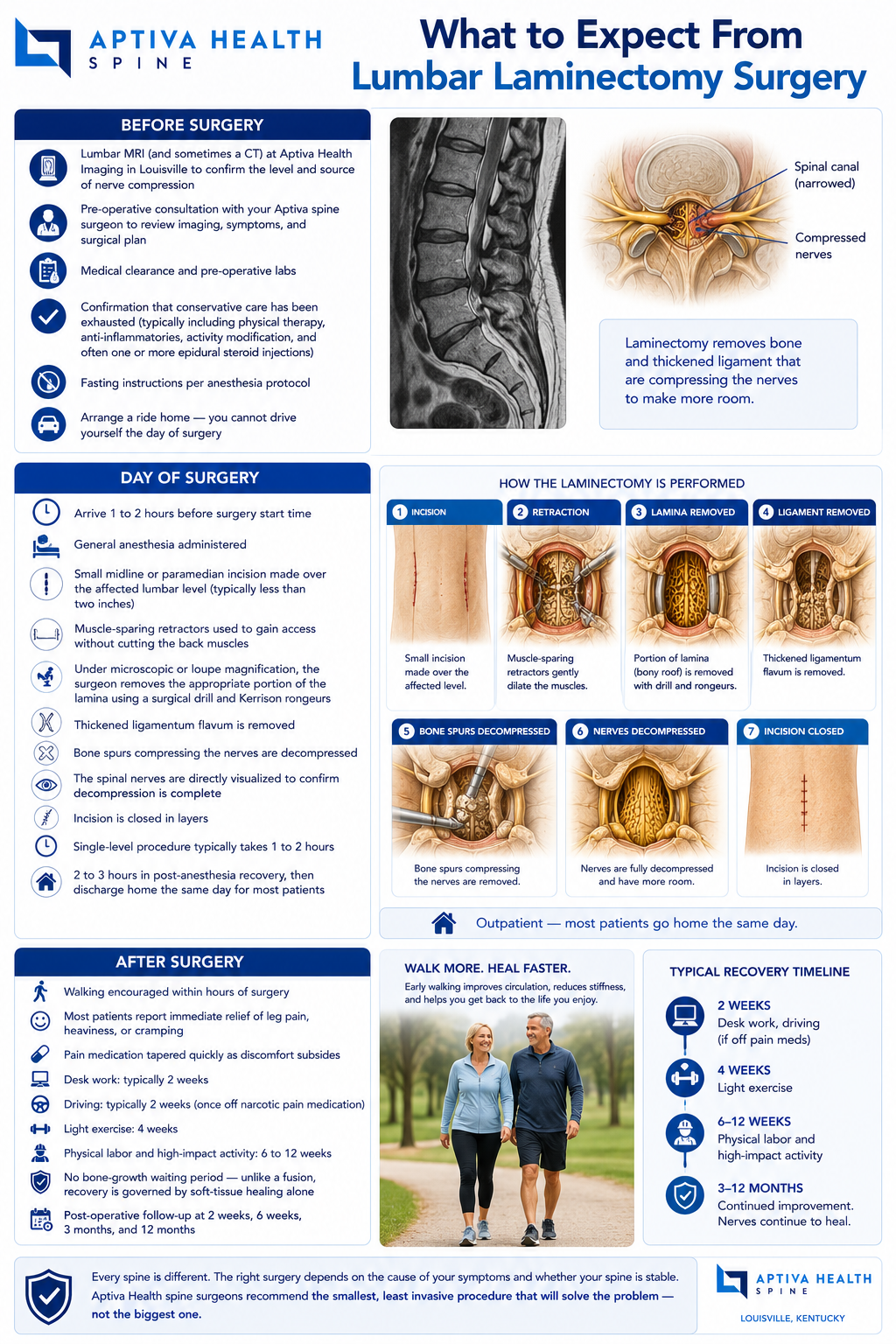 What to expect from laminectomy surgery at Aptiva Health Louisville