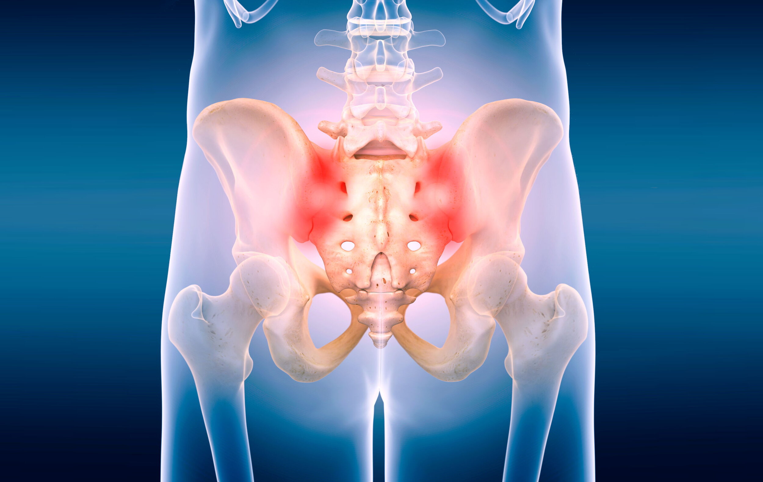 Sacroiliac (SI) Joint Injection