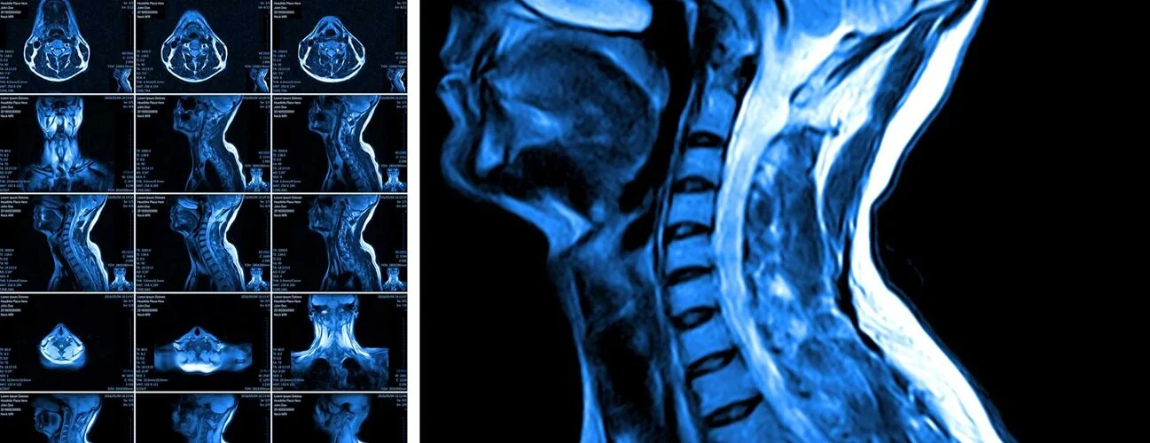 MRI Conditions We Diagnose - Aptiva Health Imaging