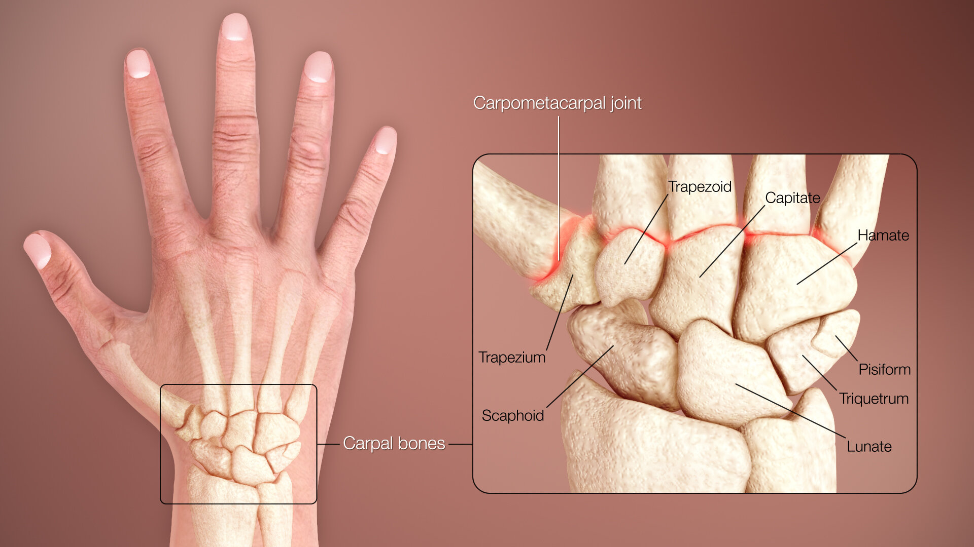 Wrist Injuries Treatment | Louisville & Lexington | Aptiva Health