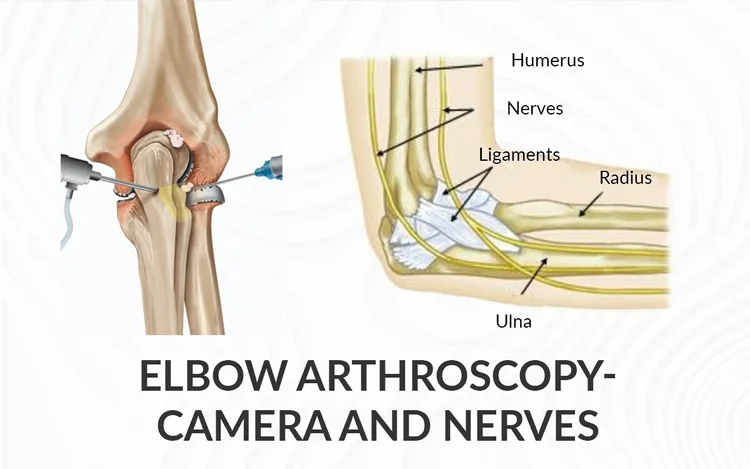 Elbow Arthroscopy | Aptiva Health