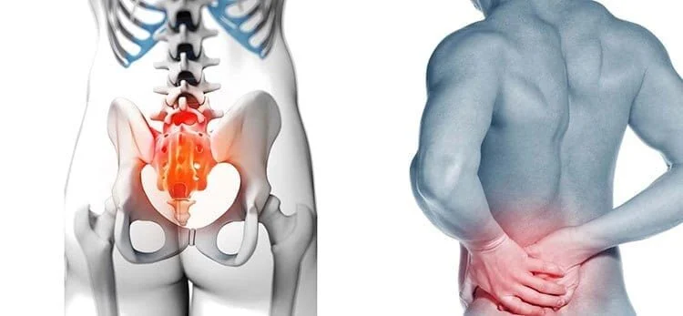 SI Joint Injury from Car Accident