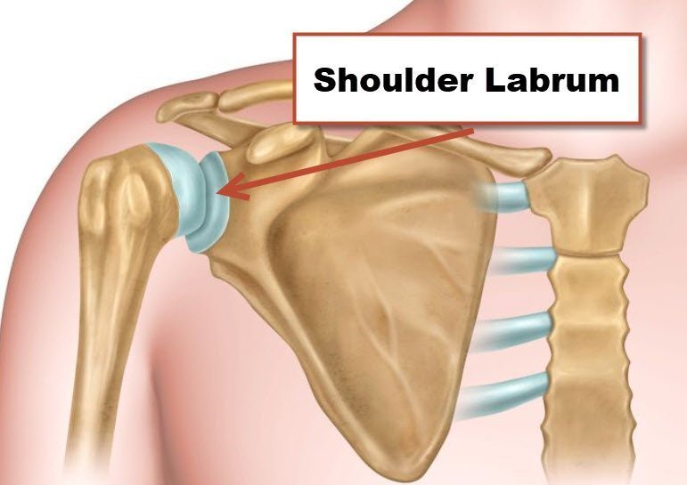 Shoulder Labrum Repair
