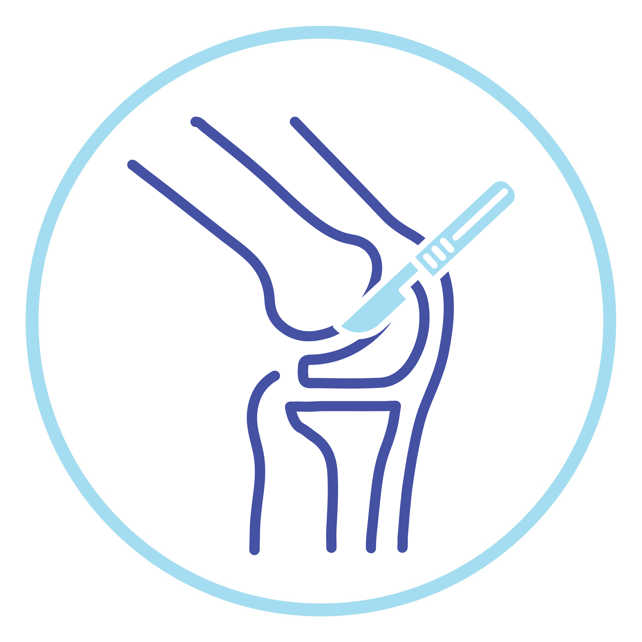 Knee Surgery