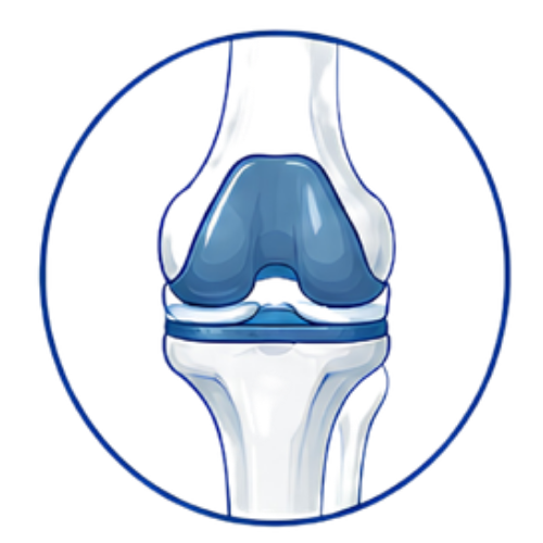 Knee Replacement (Copy)