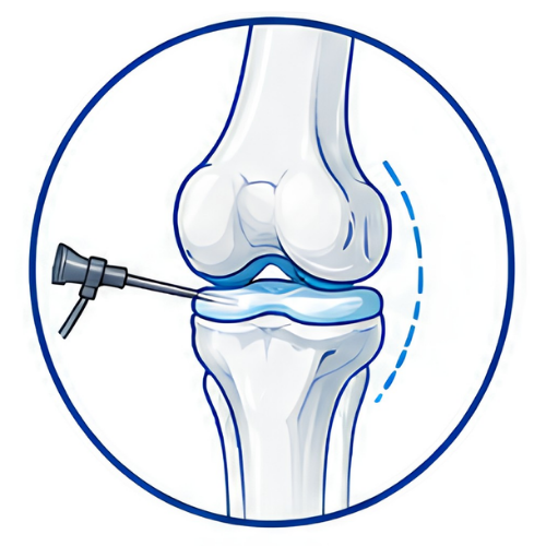 Knee Surgery (Copy)