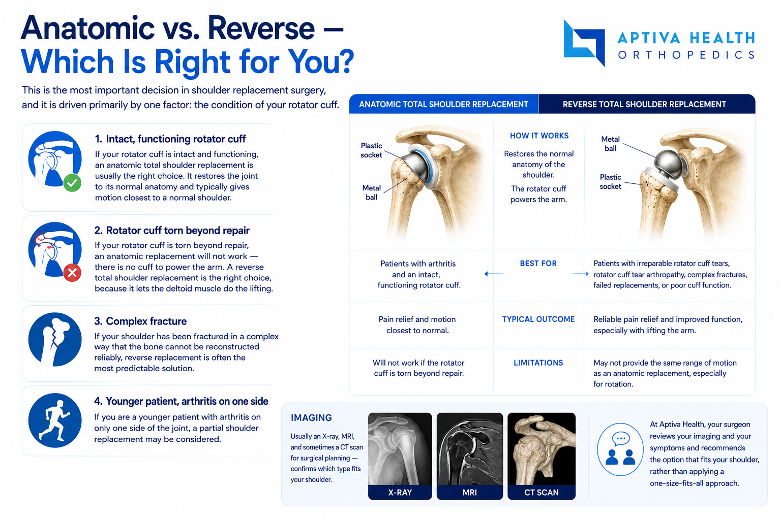 Choosing between anatomic and reverse shoulder replacement