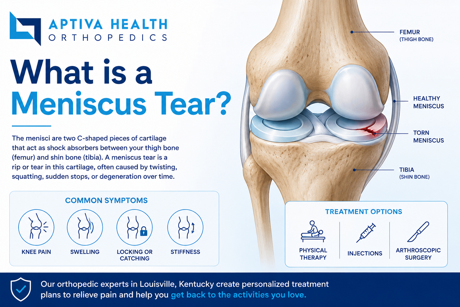 Meniscus anatomy — the C-shaped cartilage of the knee