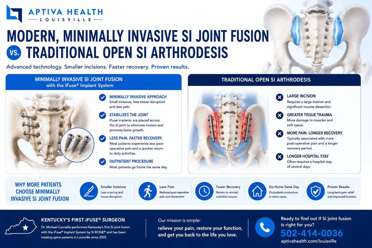 Minimally Invasive SI Joint Fusion