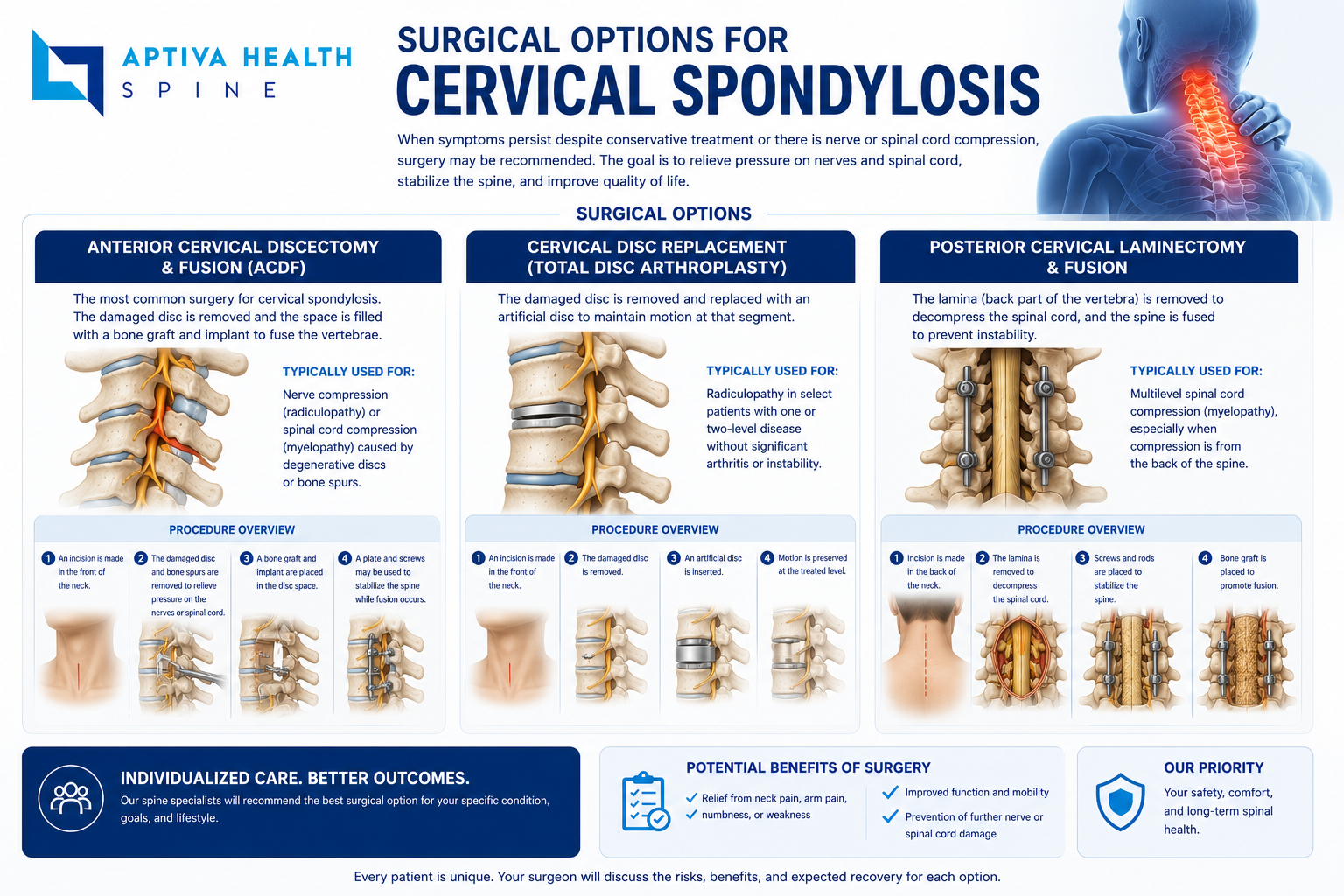 Surgical Options for Cervical Spondylosis