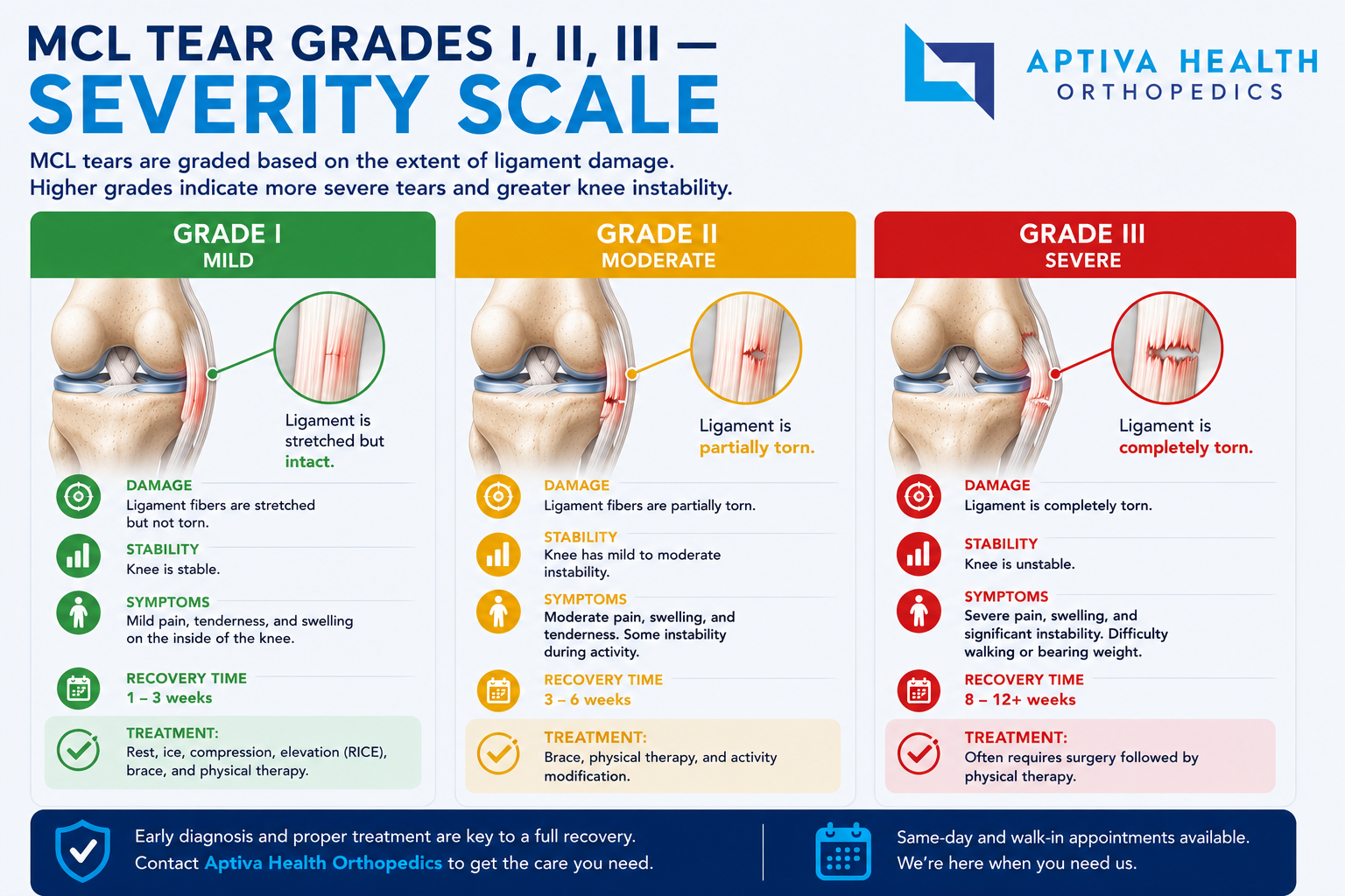 MCL Tear Grades