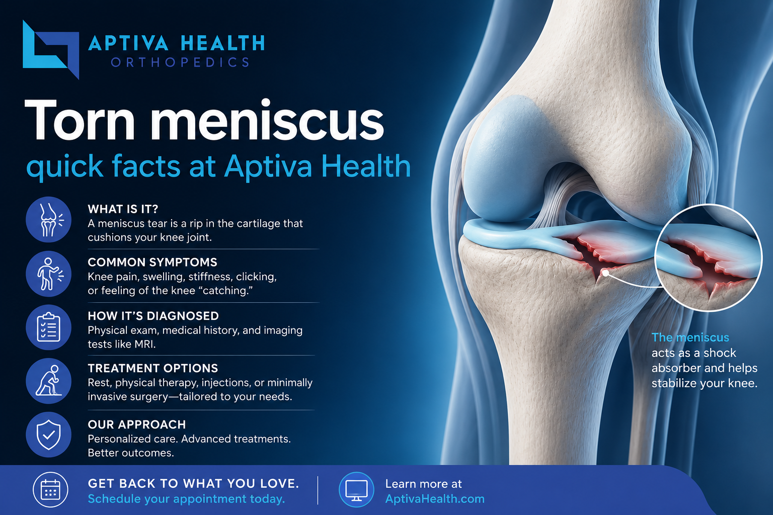 Quick Facts about a Torn Meniscus
