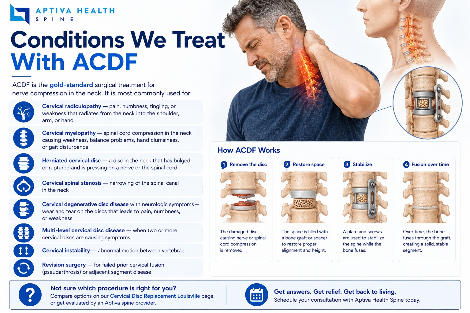 Cervical conditions treated with ACDF at Aptiva Health Louisville