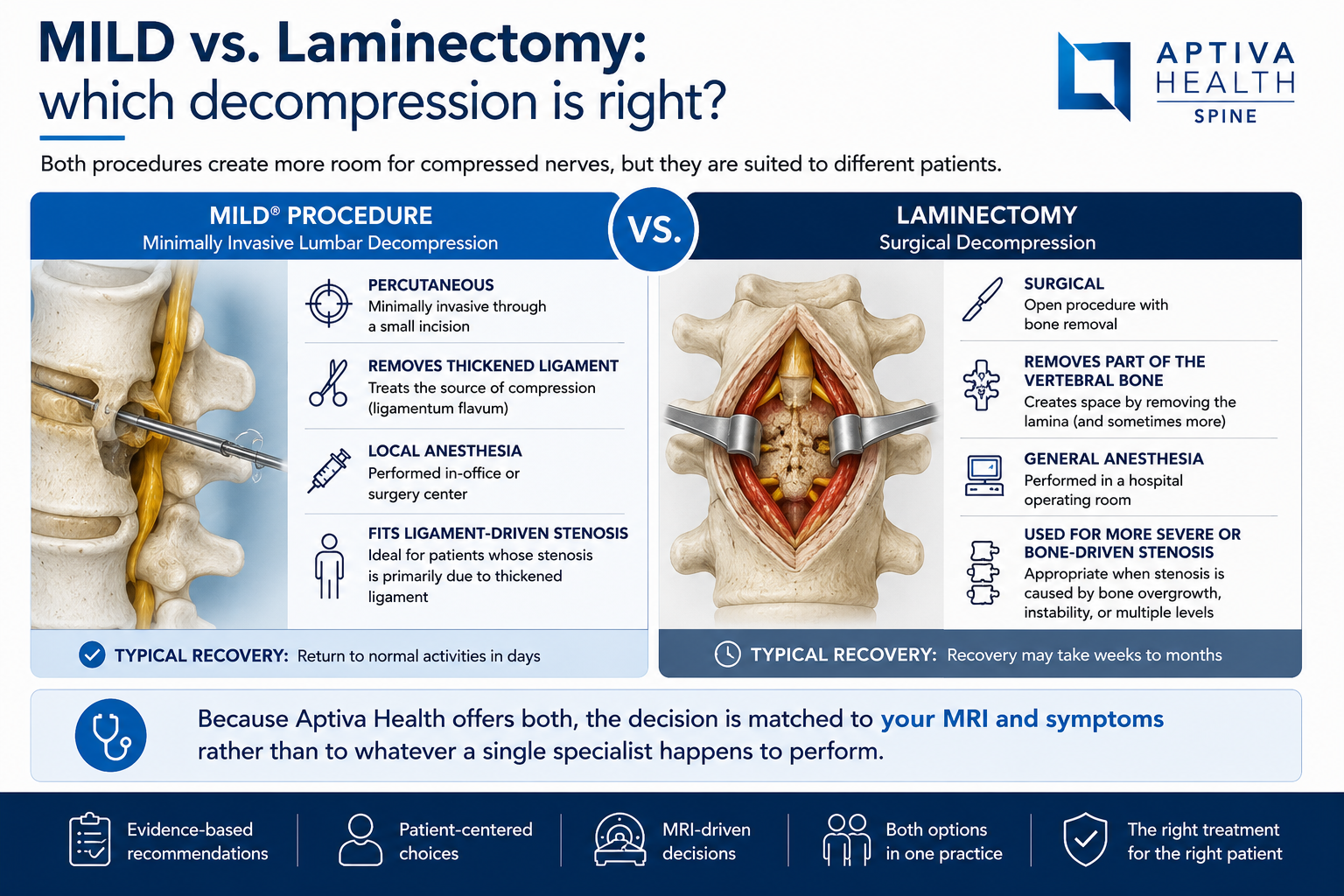 MILD Procedure vs. Laminectomy