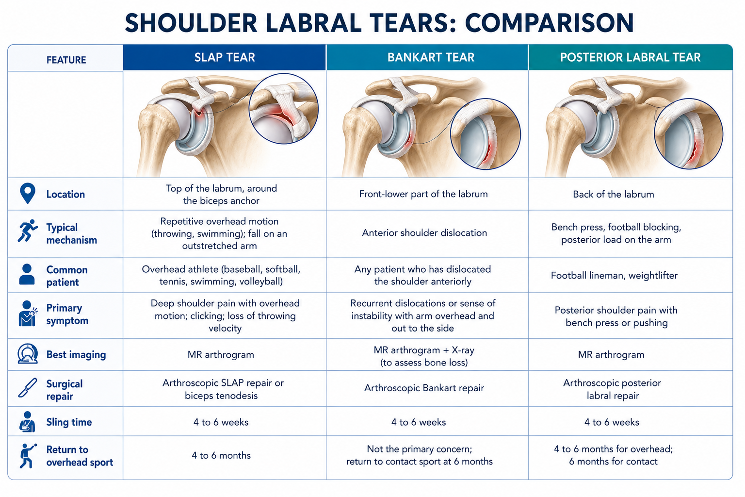 SLAP Tear versus other tears