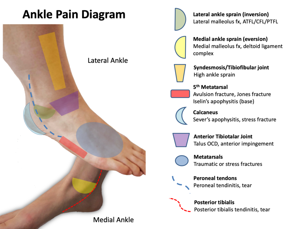 Ankle Ligament Repairs Aptiva Health