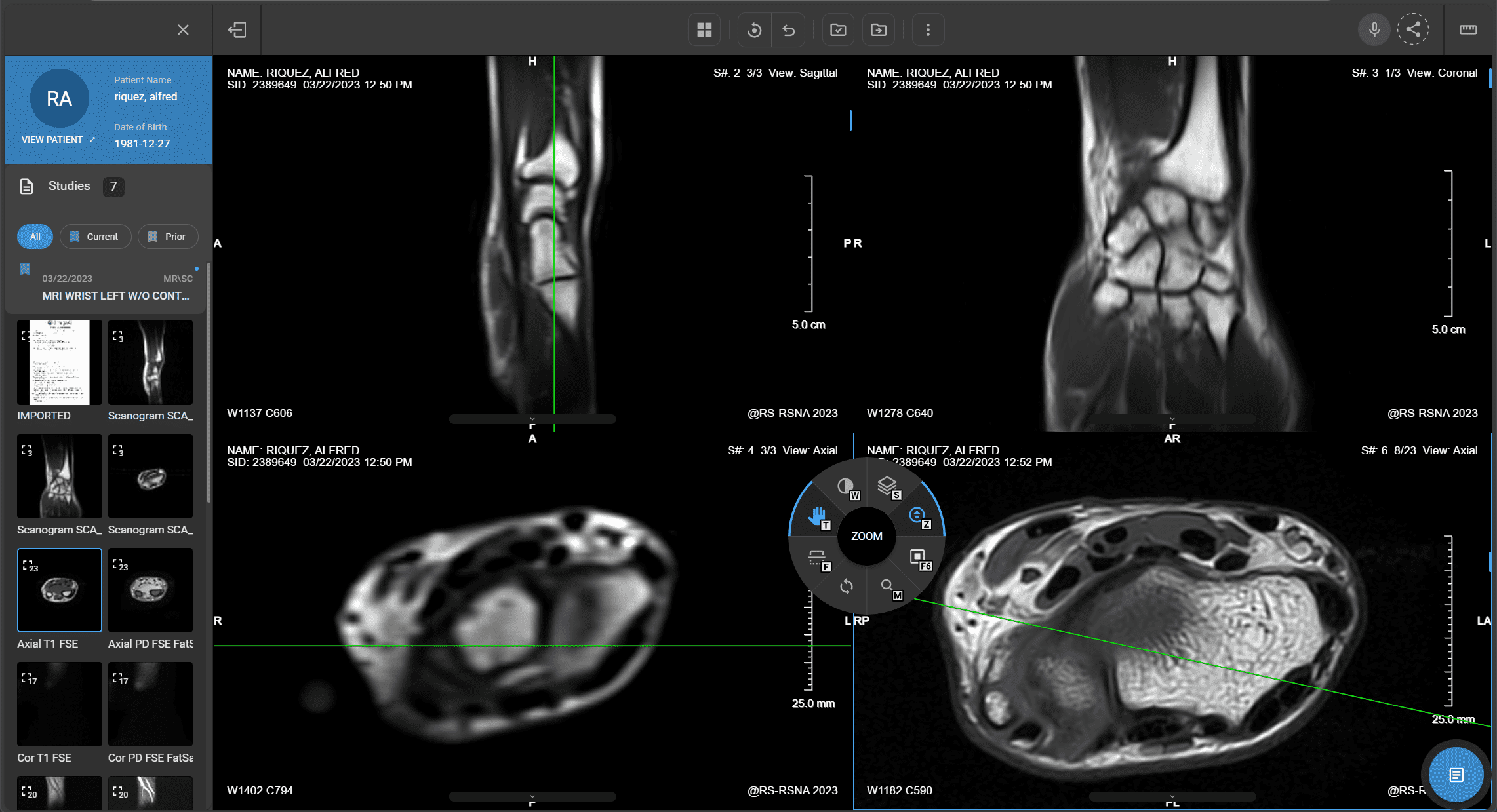 Most Requested MRI Studies at Lexington MRI
