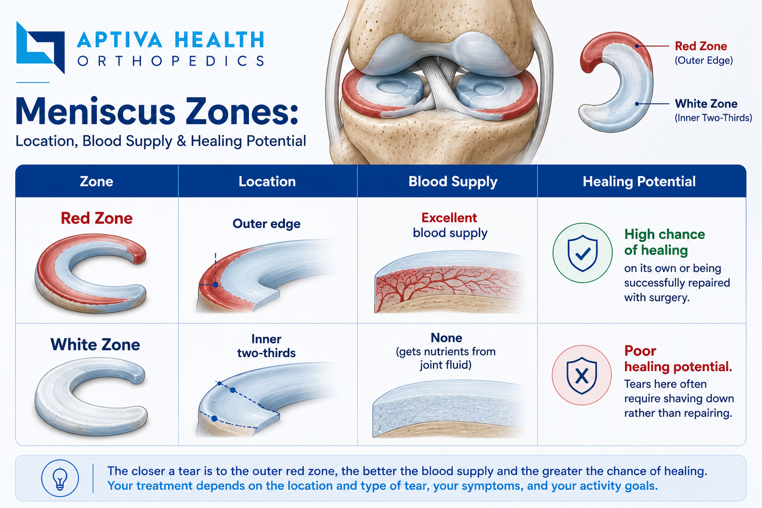 Red and White Zones of a Knee Meniscus