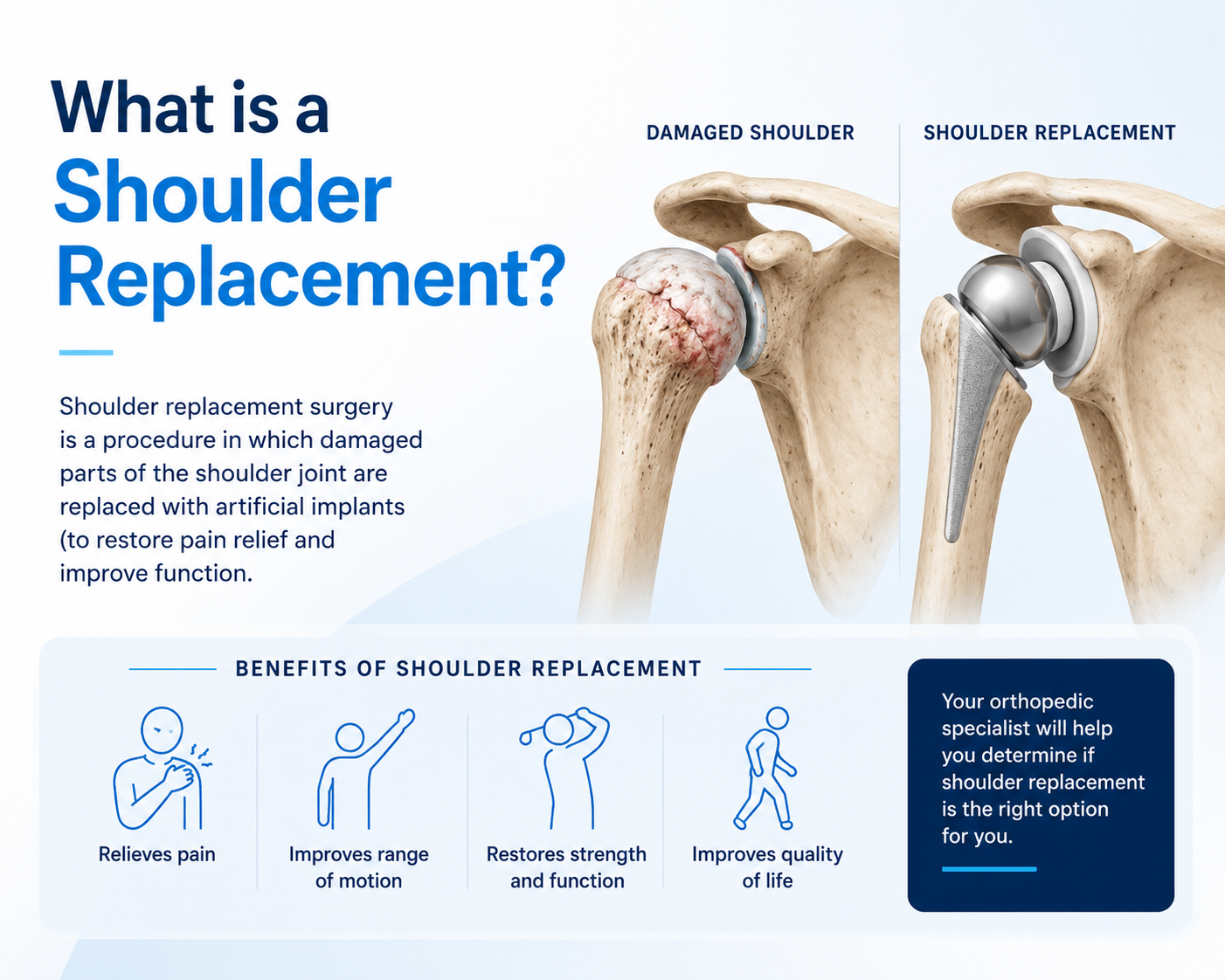 What is shoulder replacement surgery — anatomic, reverse, and partial