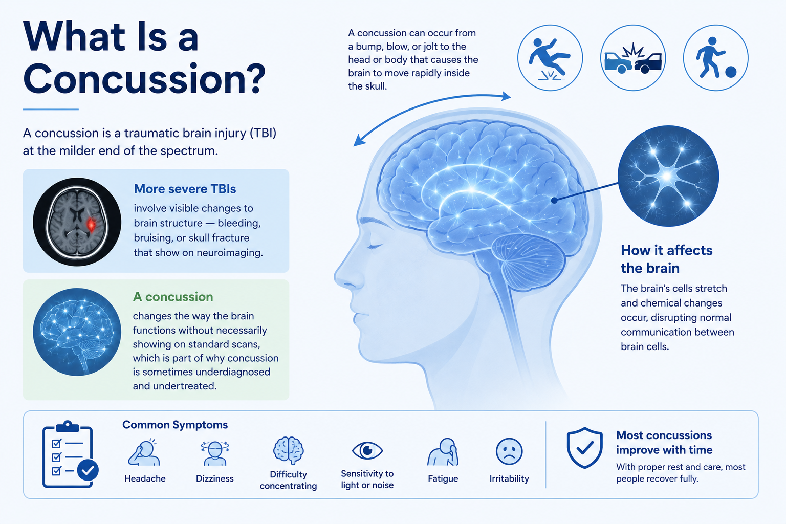What is a concussion?