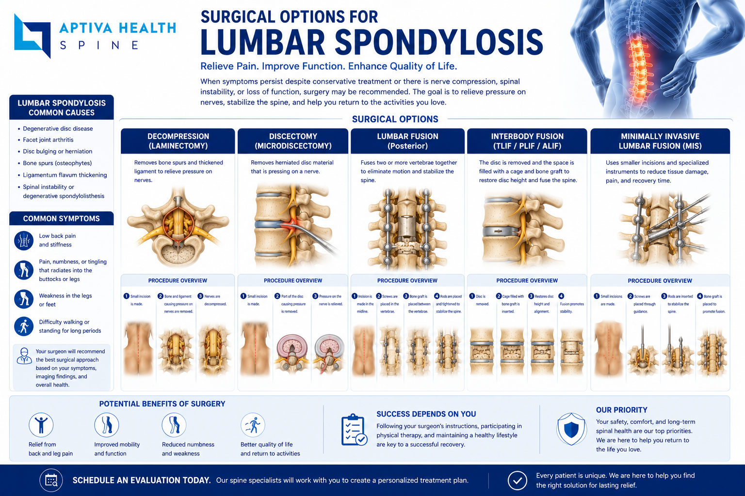 Surgical Options for Lumbar Spondylosis