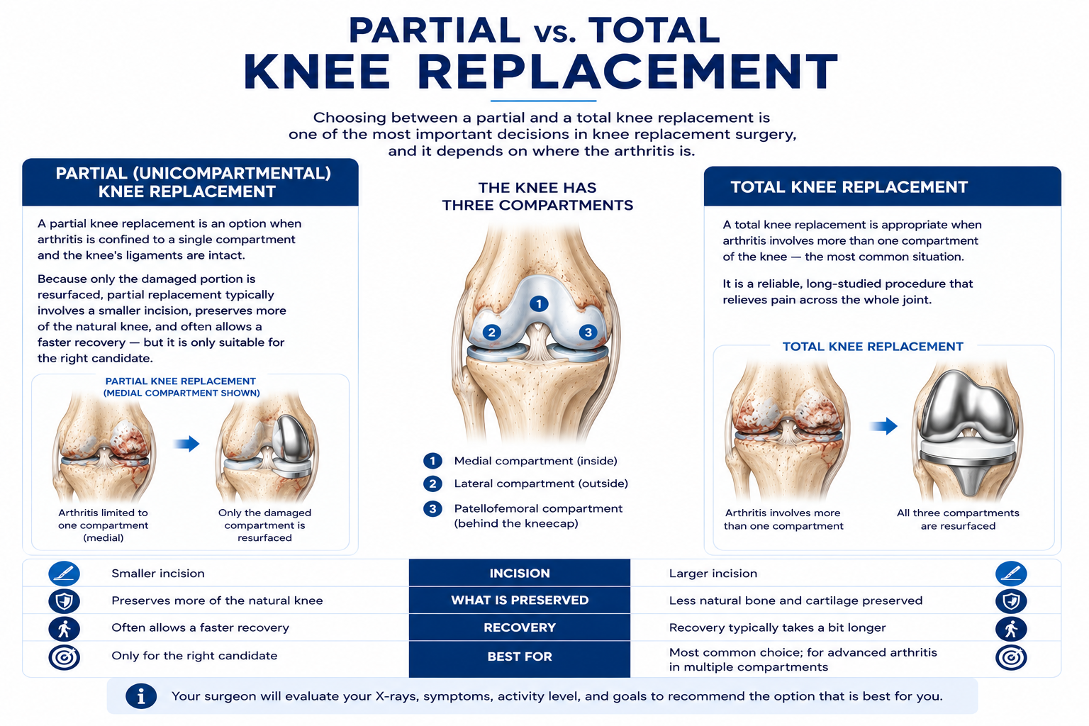 Partial knee replacement vs. total knee replacement comparison