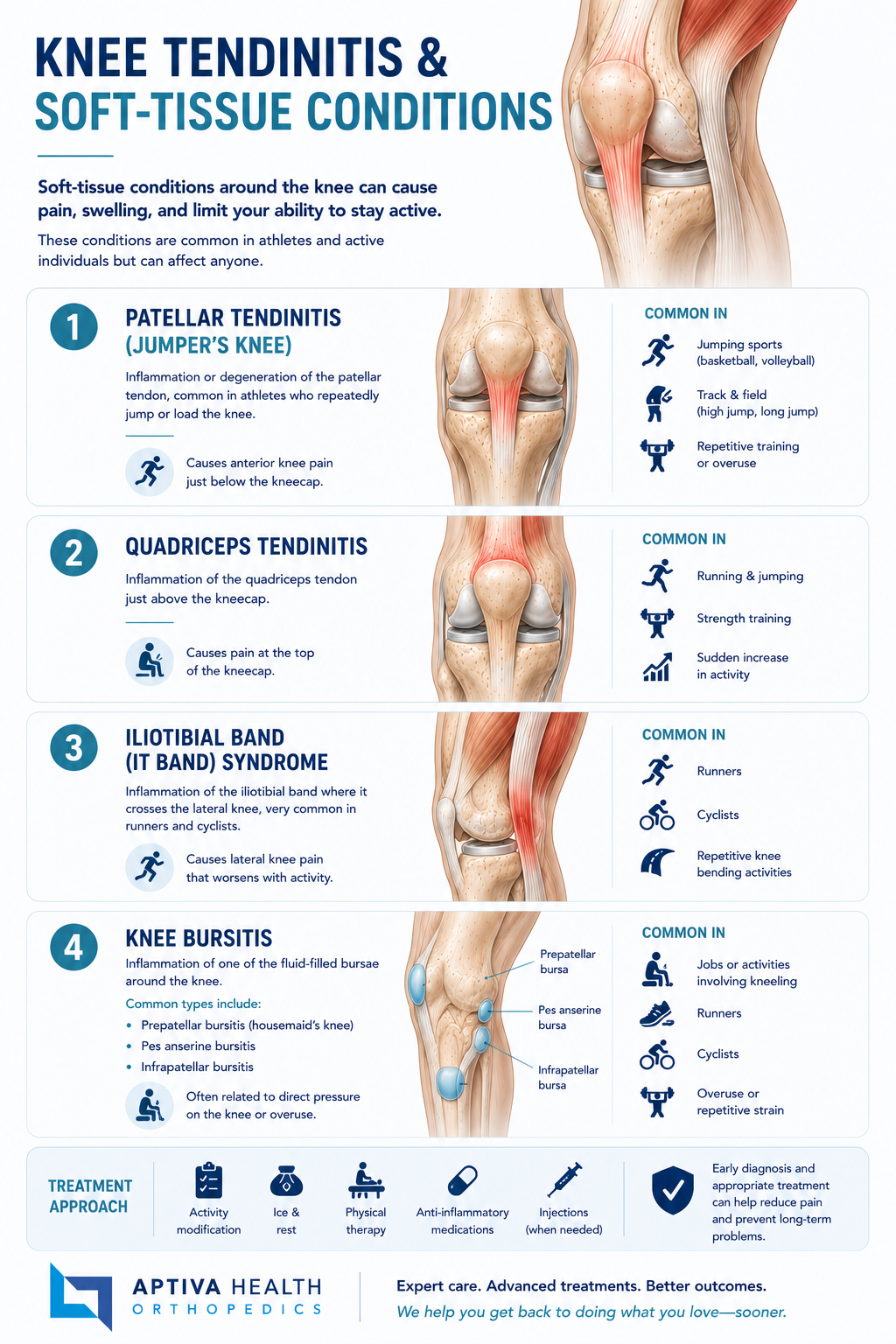 Knee Soft Tissue Conditions Treated at Aptiva Health