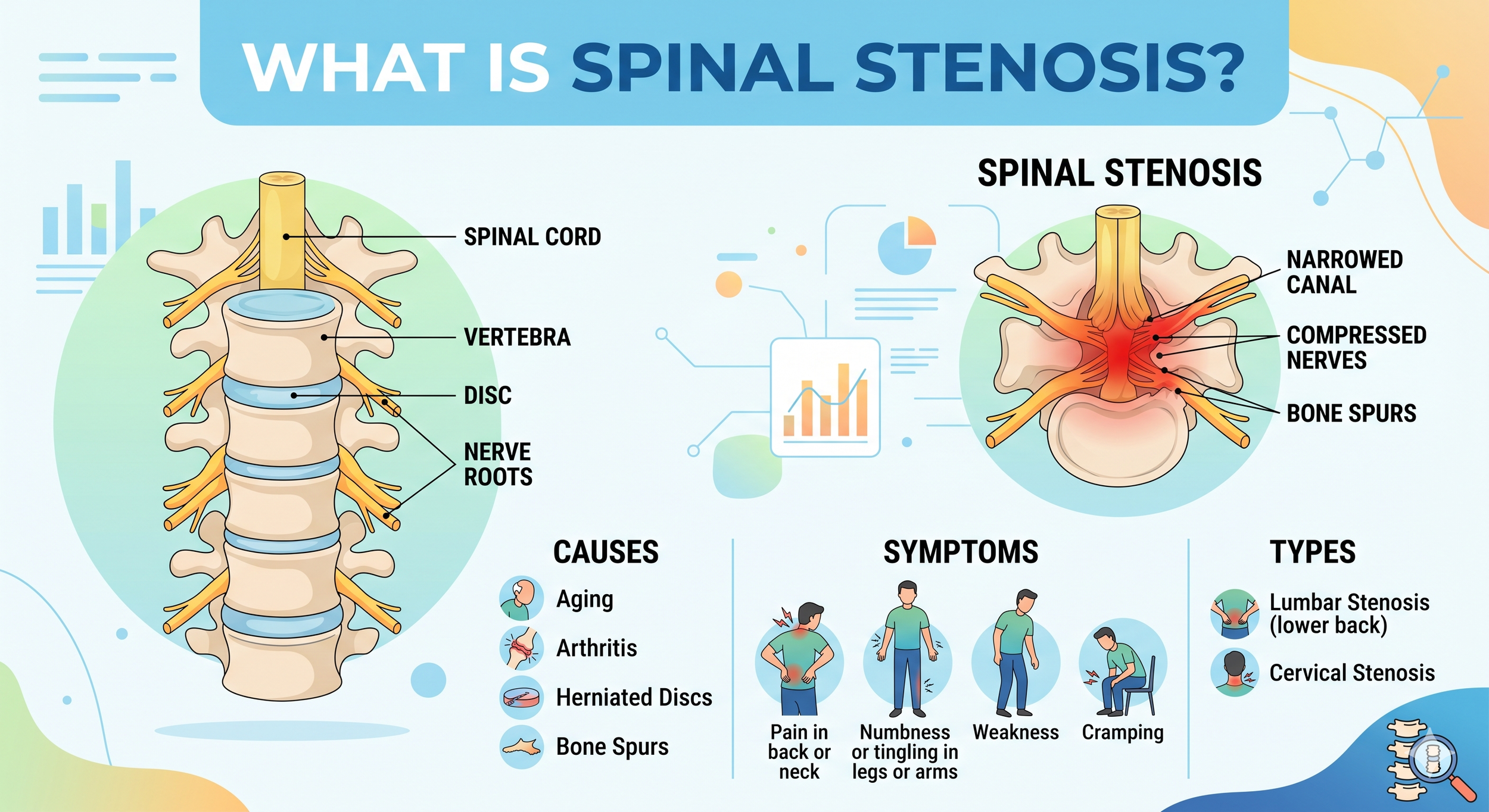 What is Spinal Stenosis?