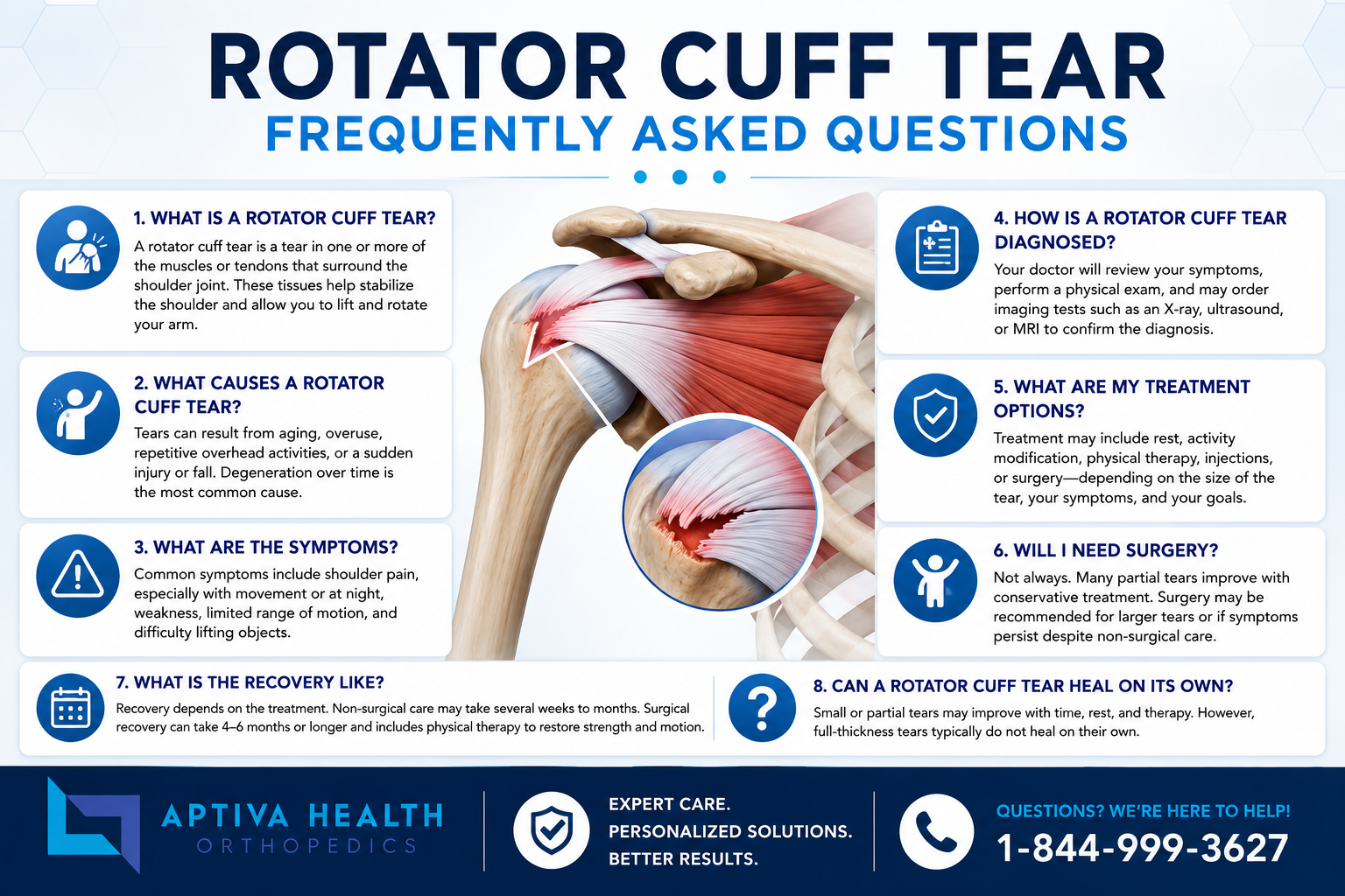Rotator Cuff Tear - Frequently Asked Questions