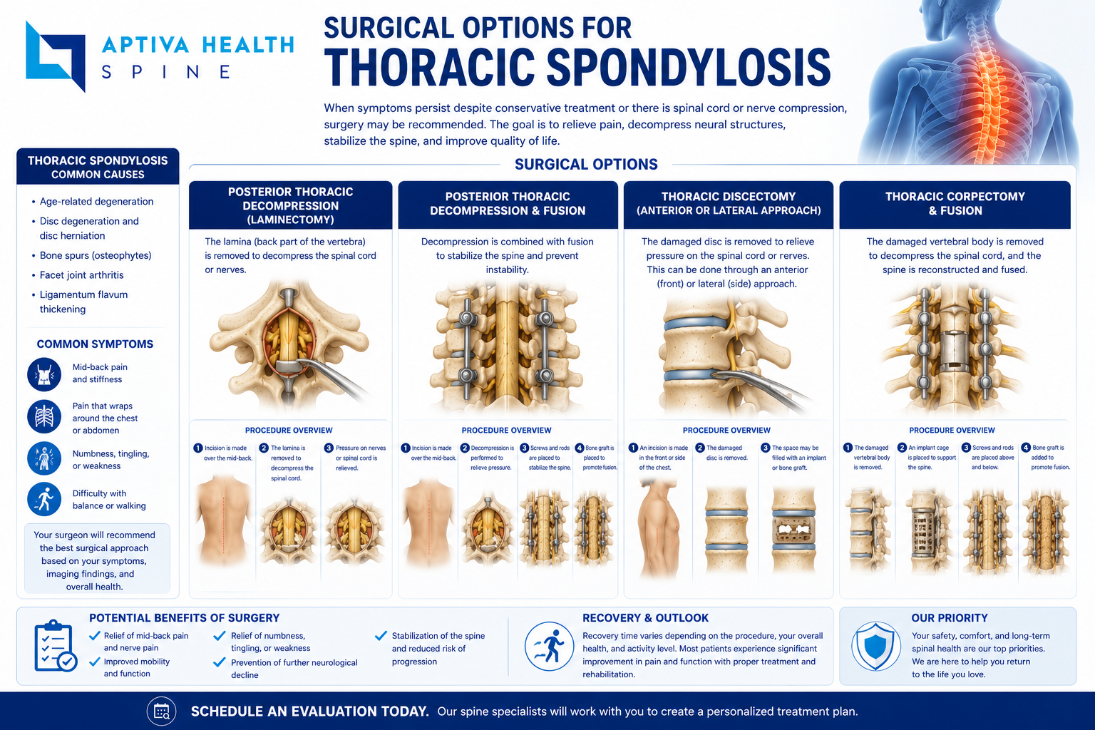 Surgical Options for Thoracic Spondylosis