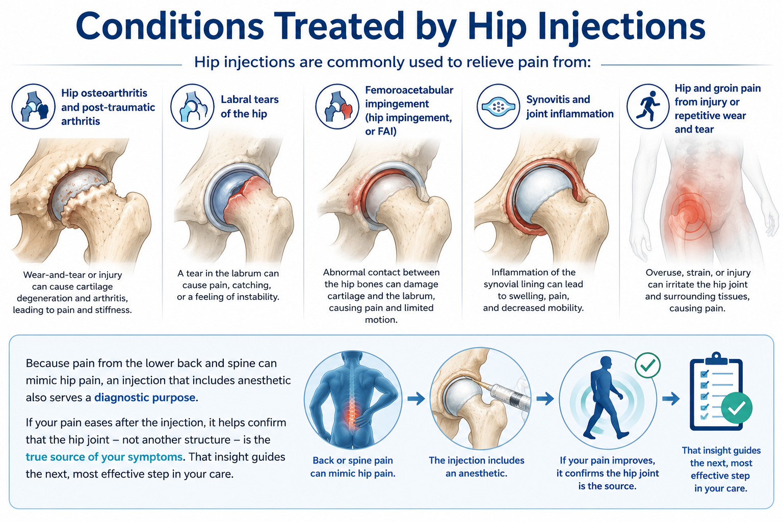 Conditions Treated by Hip Injections