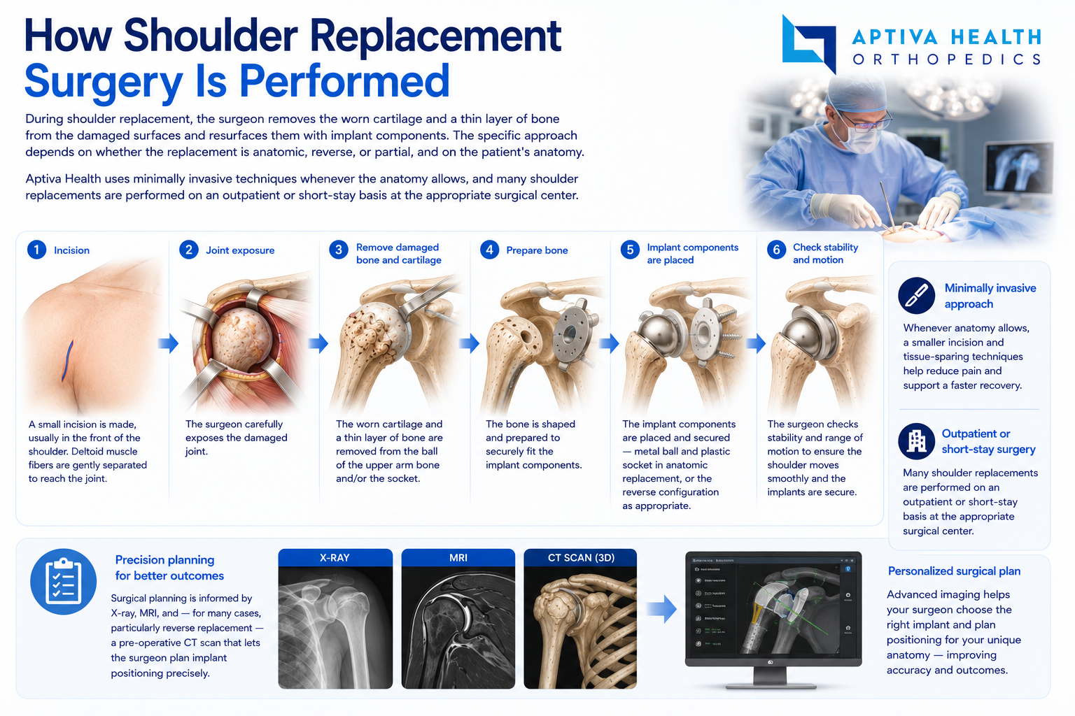 How shoulder replacement surgery is performed at Aptiva Health