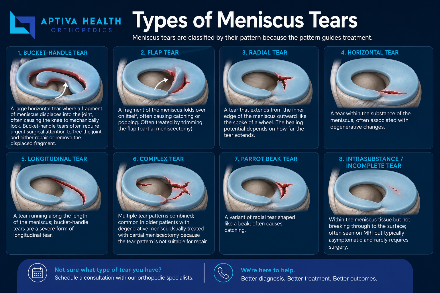 Types of Meniscus Tears